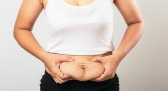 Tighten Loose Belly Skin: 7 Ways to Achieve a Flawless Midsection